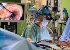 La Guida - Un caschetto con telecamera per la Cardiochirurgia mini invasiva (video)